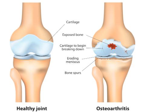Glucosamine